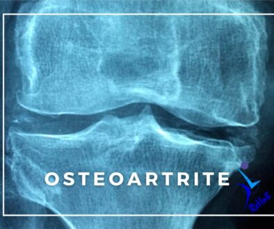 post-osteoatrite